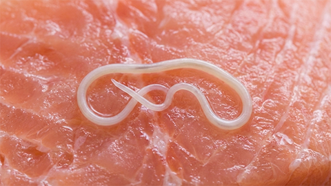 アニサキスのイメージ