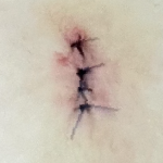 黒い糸で縫い付けられている