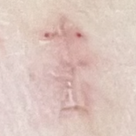 徐々に赤みが引いていく