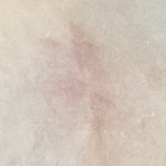 かなり目立たなくなってきた