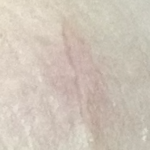 シワに紛れてきて目立たなくなってきた